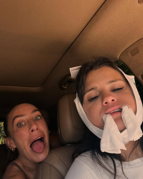 Гомес на кумедних фото показала, як лікувала зуби та стильно вдягалася цього місяця