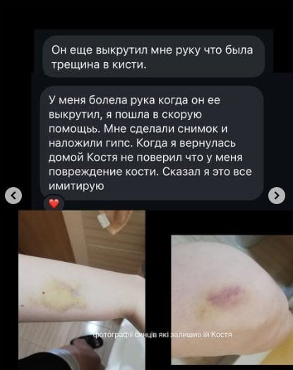 Сенсационное разоблачение: известный актер в центре скандала с домашним насилием