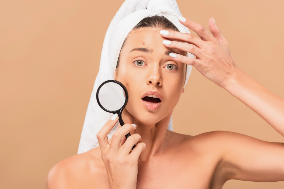 Открытые комедоны (чёрные точки): как отличить от сальных нитей и очистить поры без травм