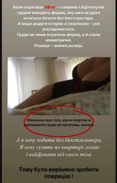 Переможниця &laquo;Холостяка-13&raquo; Інна Бєлєнь зробила пластику