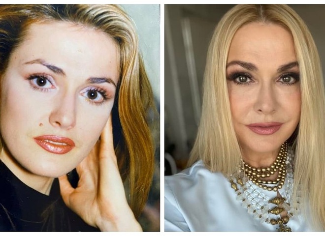 Сумська вперше зізналася, чому видалила свою фірмову родимку на обличчі